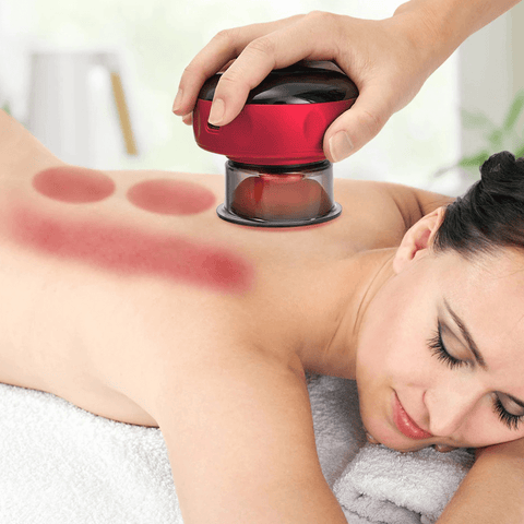 BYMCF® Smart Cupping Massage